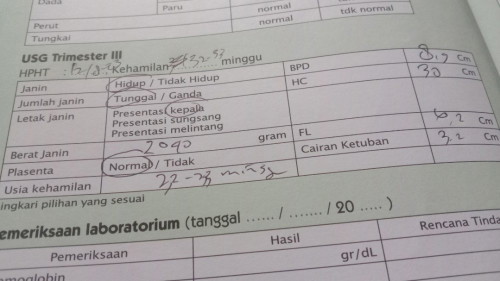 Letak janin