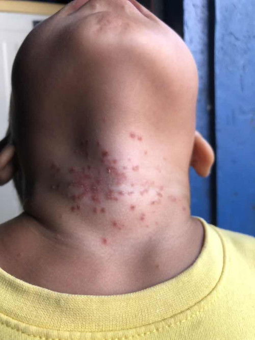 Seperti biang keringat