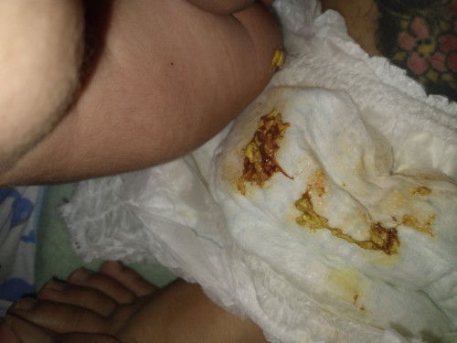 แพ้นมวัววไหมคะแบบนี้