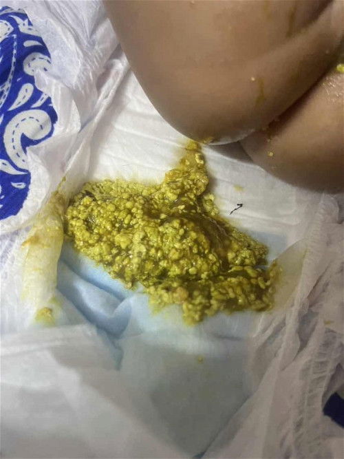 Taik bayi 5 buln berketul