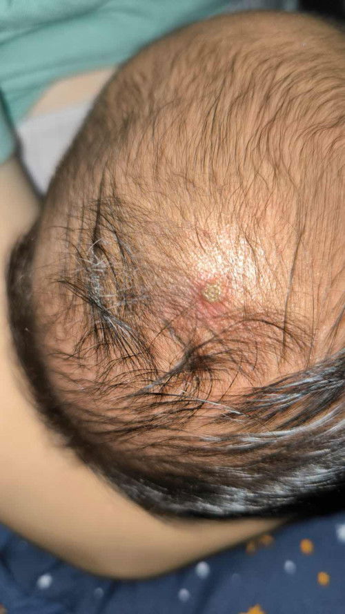 Ini kira kira kepala bayiku terkena apa ya?