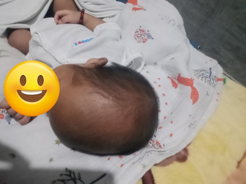 Normal lang po ba laki ng ulo ng baby ko?