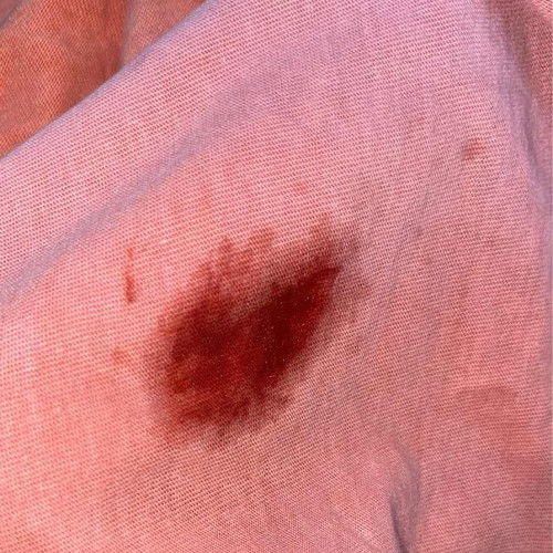 Maaf ya bun agak jorok 37week