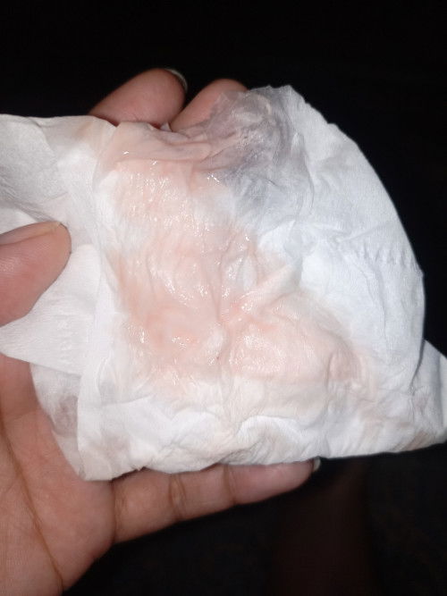 Flek 21 minggu 6 hari