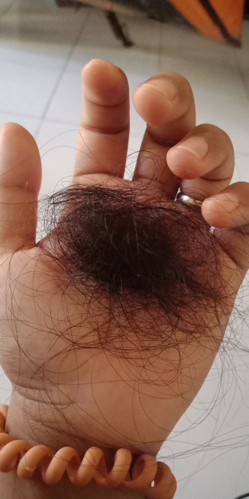 Ada yang rontoh parah pasca melahirkan g bund???aku jadi  parno,stiap sisiran pasti rontok sgini.