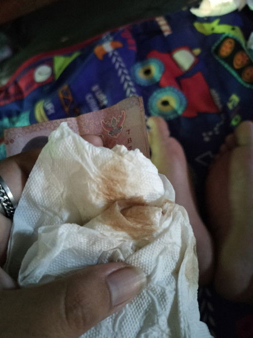 6สัปดาห์++ไม่เจอเด็ก