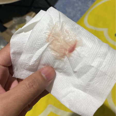 39w2dแบบนี้จะคลอดยังคะ