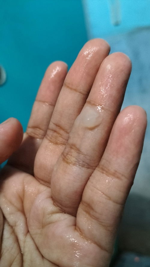 Keluar lendir seperti jelly