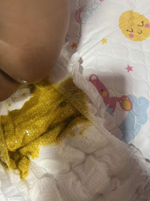 ลูกถ่ายเหลวหลังจากเป็นหวัด ไอ มีน้ำมูก