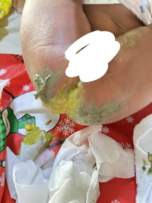 แบบนี้ปกติมั้ยคะ