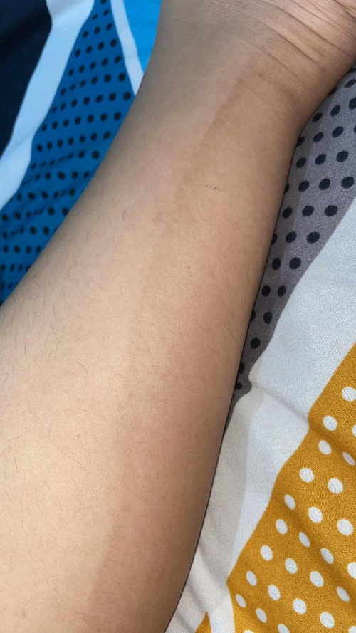 Kulit tiba” belang