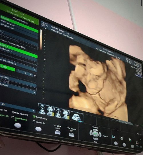 Bb janin normal atau tidak