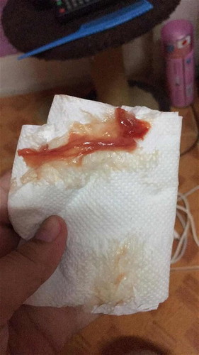 มีมูกเลือดออกหลังโดนกระตุ้น