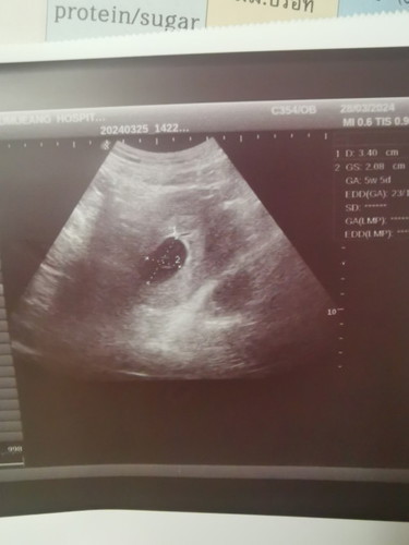 อายุครรภ์ตาม อัลตราซาวน์กับประจำเดือนต่างกันมาก