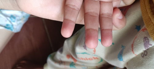 Cara hentikan kebiasaan anak menggigit tangan dan kuku