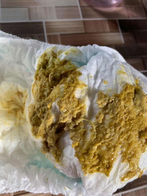 BAB agak berlendir awal MPASI