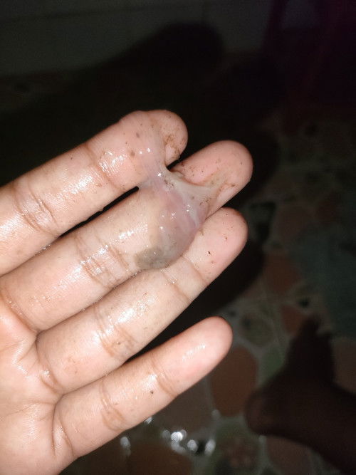 แบบนี้คืออะไร