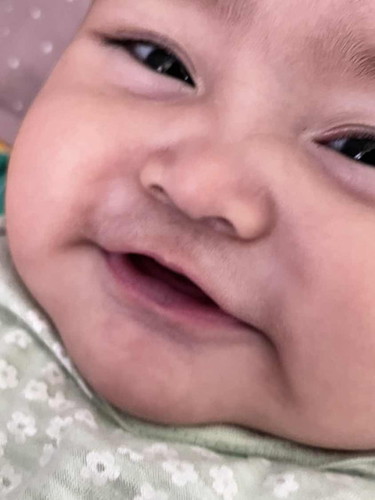 Bibir bayi 5 bulan biru