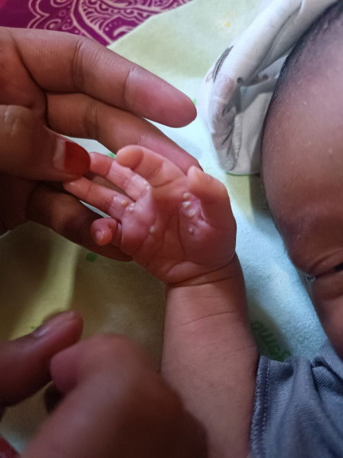 Bintik2 bayi 10 harii