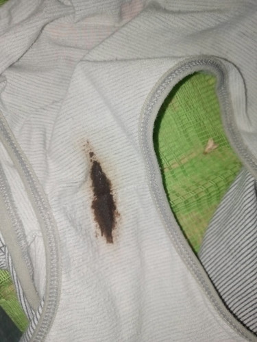 Dugo po ba to? Super nkakakaba 35weeks pa lang ako