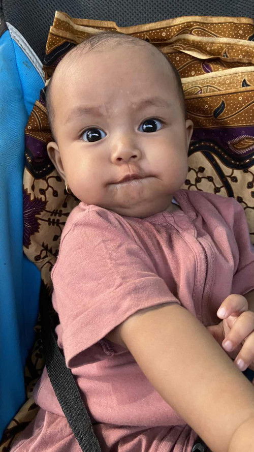 putih putih di muka bayi