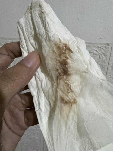 Meron po ako dark brown discharge. Ano po kaya ito? as shown in the pictures po. 14wks preggy