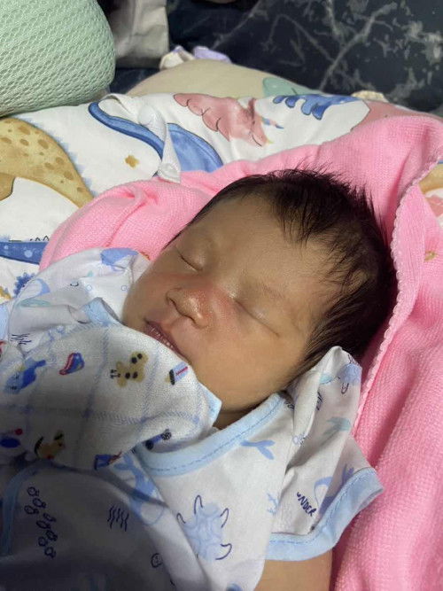 หน้าเป็นรอยแดง