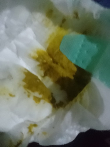 อึแบบนี้ปกติมั้ยคะ