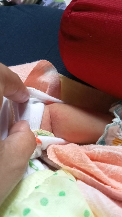 Wajar gak sih bun ini kaya gatalan