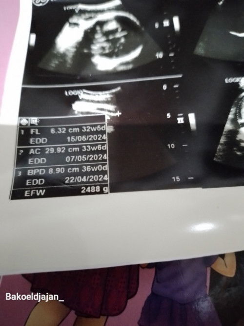 Di aplikasi ini masuk 36w tp dri hasil usg dokter terbilang hari ini masuk 37w