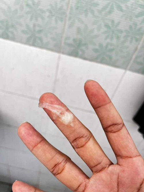 เหมือกตั้งครร35วีค