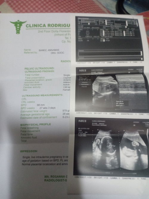 Normal lng poba nag may lumalabas na na gatas Sakin 28weeks pregnant ako ty.