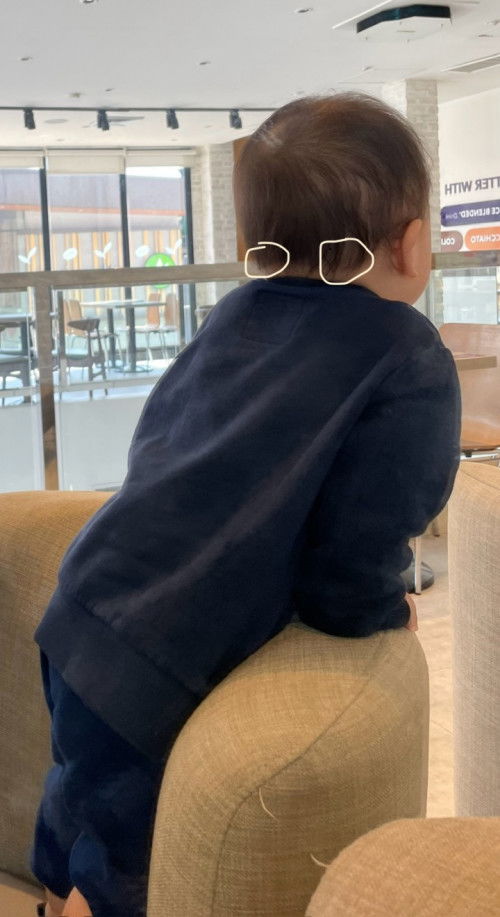 Hi mga mmy 19 months na baby ko may nakakapa ako na kulani both sides sa may bandang head