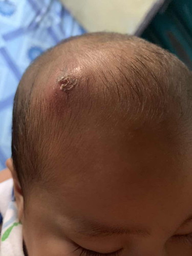 PIGSA 6 MONTHS OLD BABY BOY