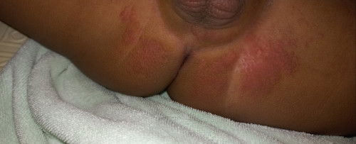 Selangkangan bayi merah²