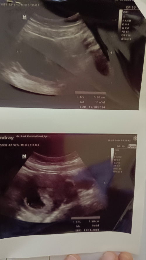 Halo bunda semuanya, baru gabung hihi