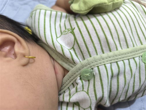 Bintik kemerahan di leher