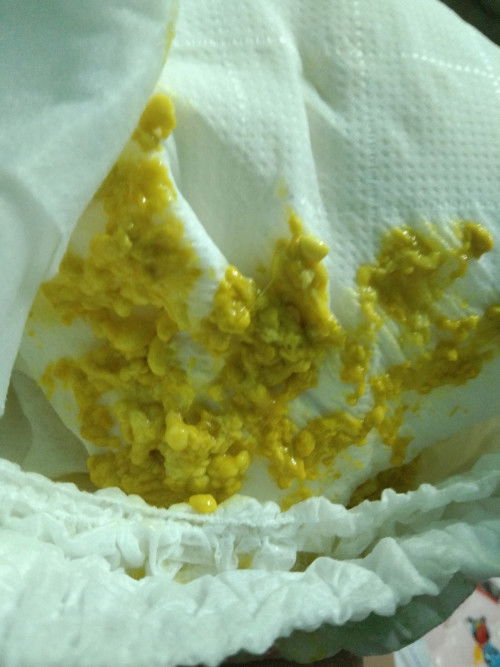 อึแบบนี้ปกติไม ????