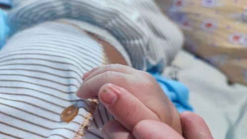 Kuku jari bayi bengkak