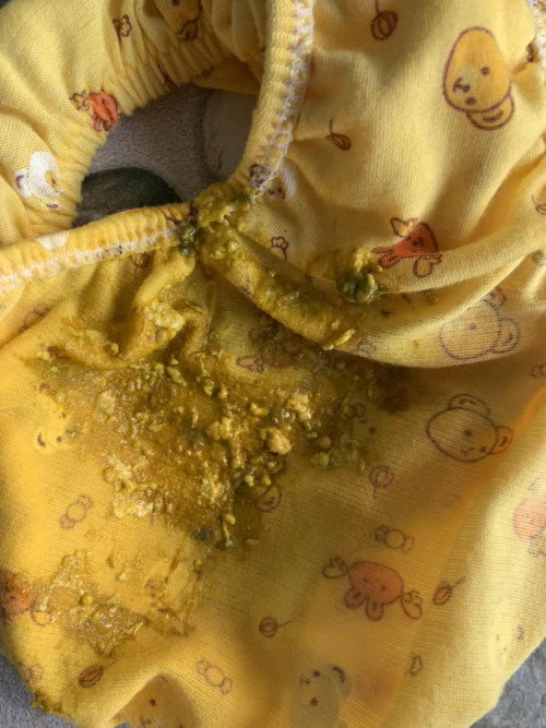 น้องอึแบบนี้ปกติไหมคะ