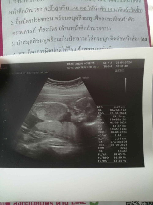 น้องไม่ยอมอ้าขาค่ะ หมอเลยเดาว่า เป็นผู้หญิง.💕