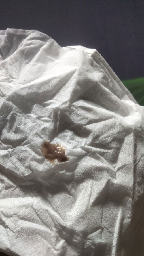 Gumpalan lendir agak kecoklatan