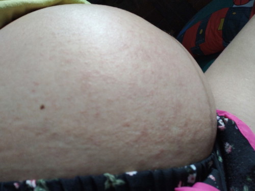 35 วีค มีผื่นคัน