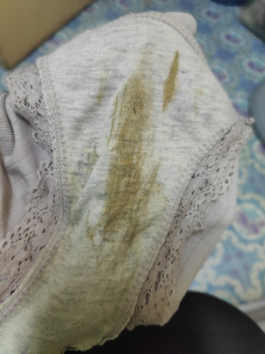 Hi Mommies. sy dah 14w dan pagi nie ada kesan mcm nie kat panties. perlu ke sy ke KK? @ ini normal?