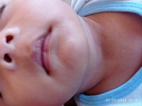 Asko po mga mommys if normal po bang namumuti labi ni baby dahil sa laway.?