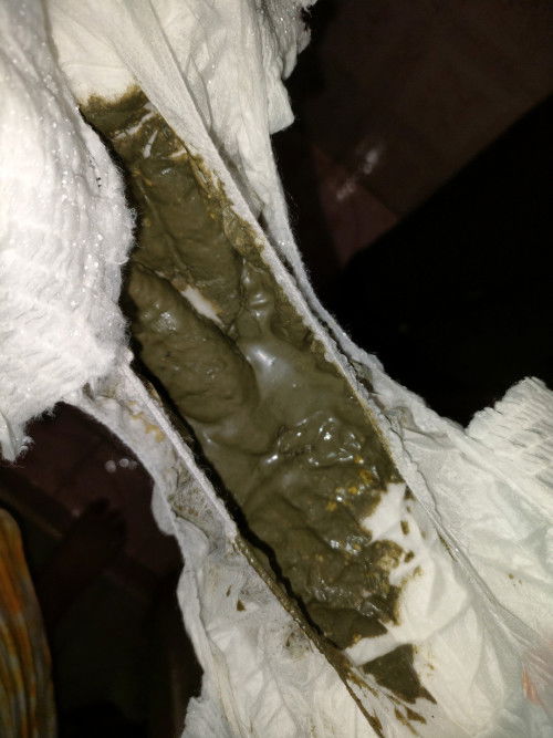 Serius nanya bun agak jorok tapi