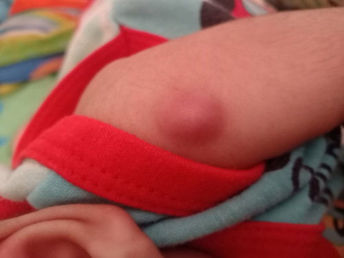 น้อง2เดือน