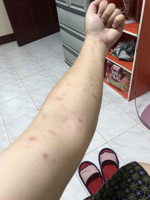 แชร์ประสบการณ์