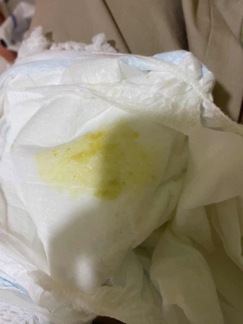 แบบนี้คืออึปกติไหมคะ