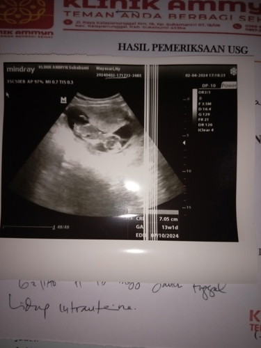 Usg pertama